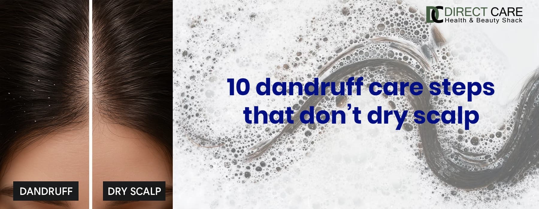 10 Dandruff Care Steps That Don’t Dry Scalp