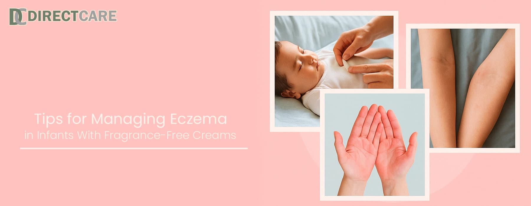 Tips for Managing Eczema in Infants With Fragrance-Free Creams